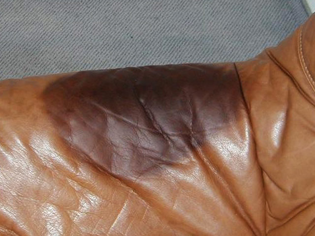 Bestand:Fettstelle-Anilin.jpg