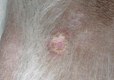 Bestand:Geschwuere-02.jpg