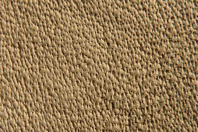 Bestand:Narbe-Anilin-Poren-08.jpg