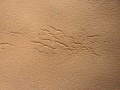 Lederschaden-Enthaeutung-01.jpg